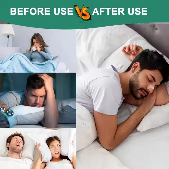 Customized Breathe Right Nasal Strip for Better Breathing Household Medical Device 5