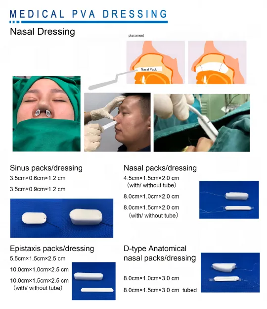 Medical Disposable PVA Dressing Nasal Sponge Dressing Hemostatic Sponge 3