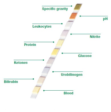 100 urine creatinine test strips 3