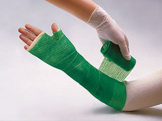Medical Polypropylene Casting Tape Orthopaedic Bandage With Low Polyurethane Resin 3