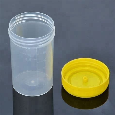 Disposable sterile plastic medical cup urine cup hospital urine container with screw cap 2
