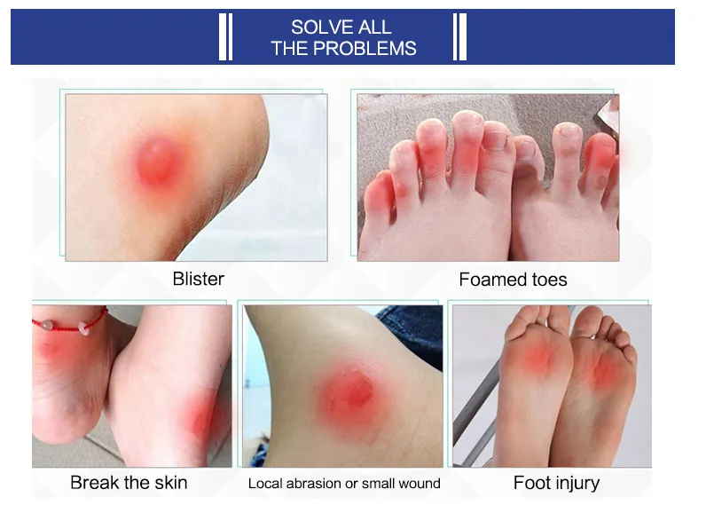 Medical Adhesive Hydrocolloid Dressing Foot Patch Dressing 5