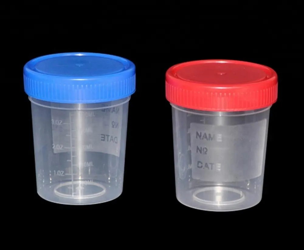 Disposable sterile plastic medical cup urine cup hospital urine collection container with screw cap 4