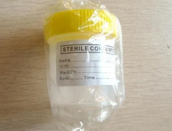 Disposable sterile plastic medical cup urine cup hospital urine collection container with screw cap 5