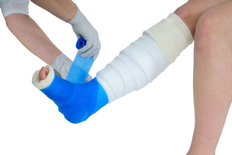 Medical Polypropylene Casting Tape Orthopaedic Bandage With Low Polyurethane Resin 4