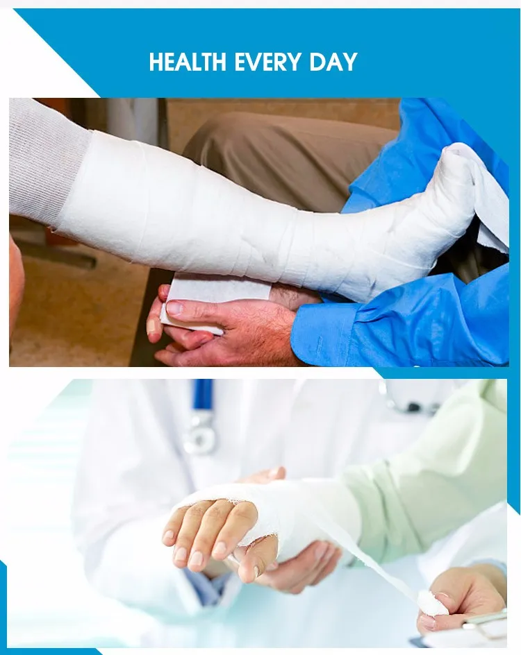 POP Plaster of Paris Bandage Cast Fast Setting POP 4