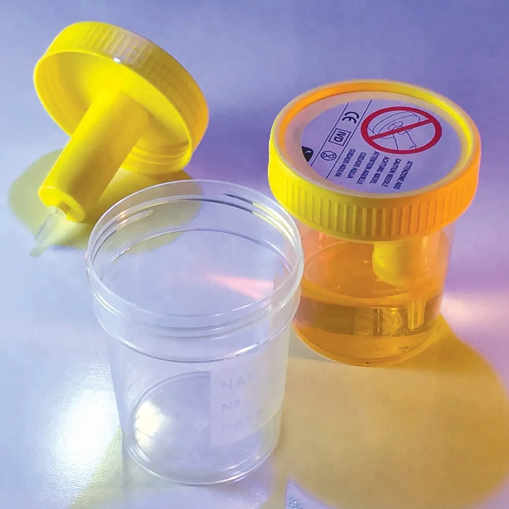 Disposable sterile plastic medical cup urine cup hospital urine container with screw cap 3