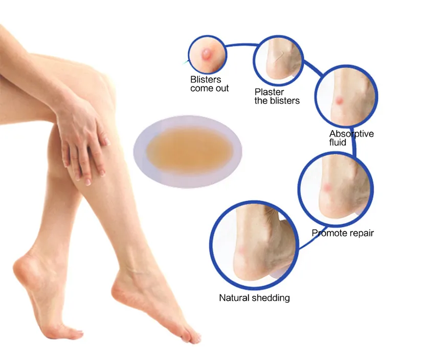 Medical Adhesive Hydrocolloid Dressing Foot Patch Dressing 3