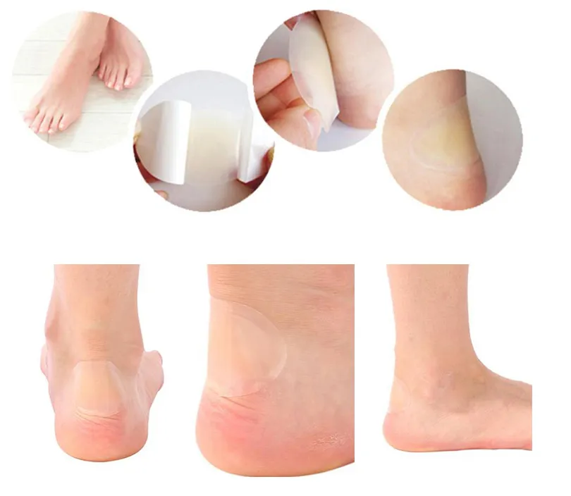 Sterile Adhesive Wound Dressing Pad Hydrocolloid Dressing 3