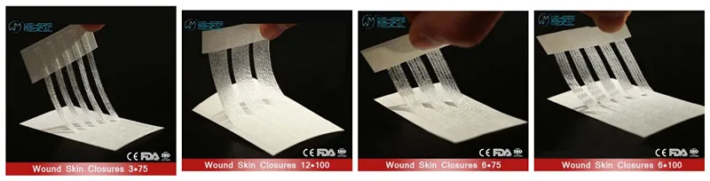Wound skin closures