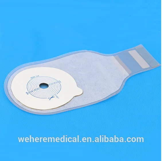 Bolsa de ostomía