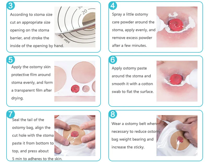 One-piece colostomy bags (piece artificial anus bag) hydrocolloid adhesive 12