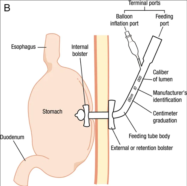 Medical Disposable PVC Stomach tube with FDA,CE,ISO 7