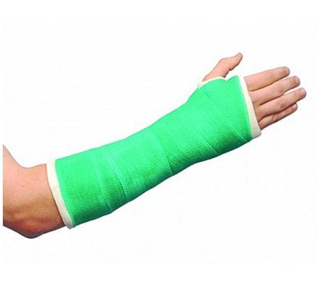 Surgical fracture supply orthopedic cast tape 2